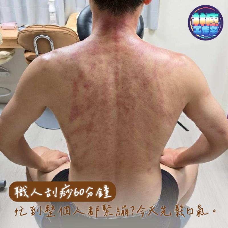 新竹【林療工作室】職人刮痧推薦｜精準鬆解緊繃60分鐘 (MO)